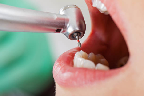 Best Emergency Denture Repair in Harkers Island, NC